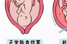 濮阳市妇幼保健院能做试管吗？哪些人可以做试管婴儿？
