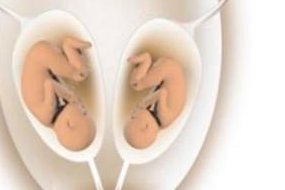 泰国三代试管婴儿收费详解，让您无后顾之忧